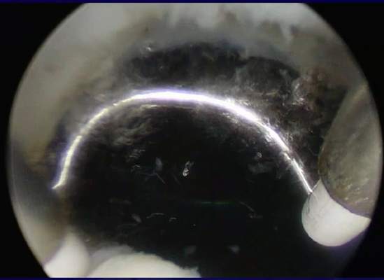 Elétrodos cirúrgicos do plasma da radiofrequência para BPH e outras doenças da urologia