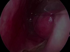 Proba de Neurologia Ultrapequena e Flexível PLA407